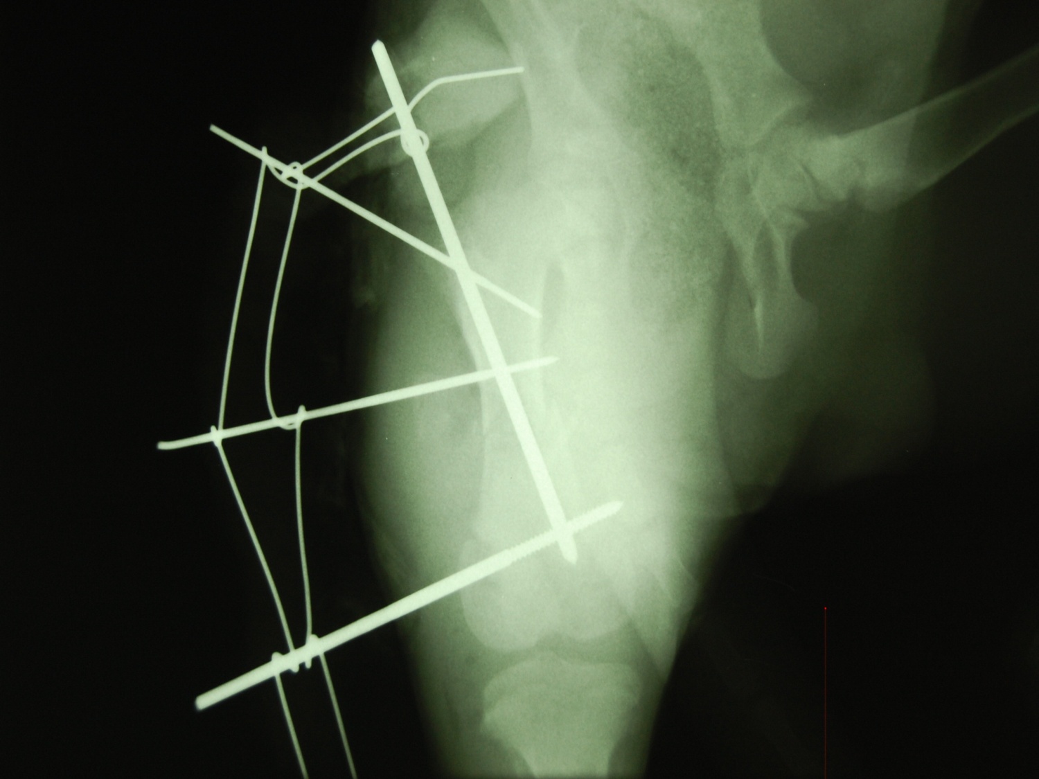 Owczarek niemiecki – Wieloodłamowe złamanie trzonu kości udowej