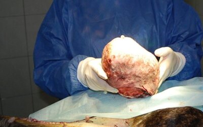 Operacja chirurgiczna u starszego pacjenta
